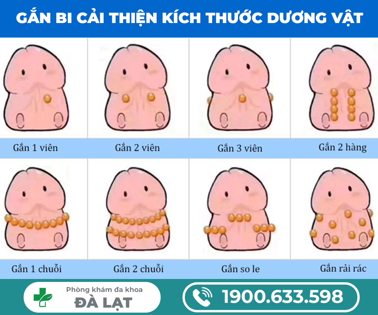 Hình ảnh minh họa